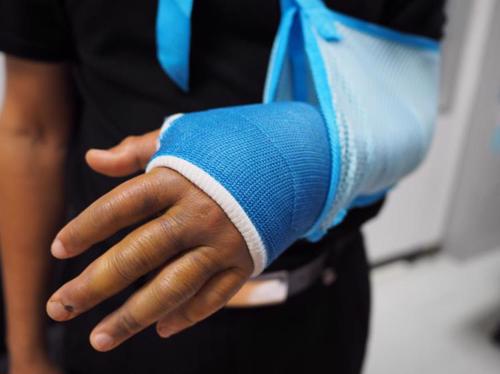 A closeup photo of a person with an arm injured by a third party's negligence.