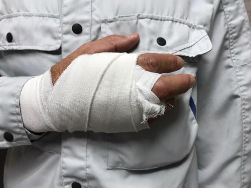 A man with a bandaged hand.